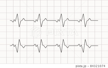 Heartbeat ecg electrocardiogram vector graph wave line. Ekg cardio heart beat cardiology frequency 84321074