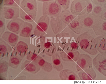 接眼ミクロメーターでの観察 接眼ミクロメーターでの観察 84342640