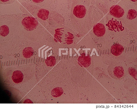 細胞分裂前期の状態と後期の状態 84342644