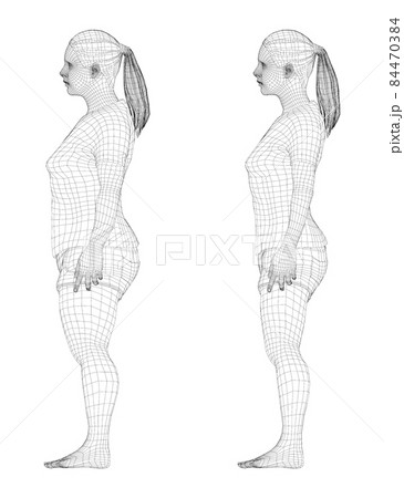 Fat and slim woman, before and after weight loss 84470384