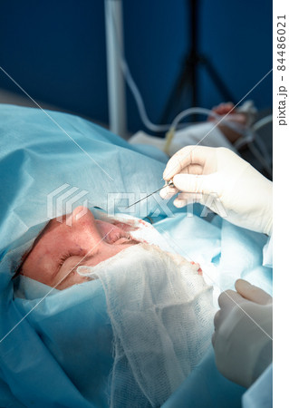 Close up of the face of a patient who is undergoing blepharoplasty. The surgeon cuts the eyelid and performs manipulations using medical instruments Close up of the face of a patient who is undergoing blepharoplasty. The surgeon cuts the eyelid and performs manipulations using medical instruments 84486021