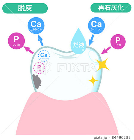 歯(イメージ) 歯(イメージ) 84490285