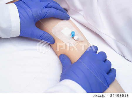 A doctor in medical gloves holds the patient's hand with an intravenous catheter. Concept of human blood diseases, leukemia, copy space for text 84493613