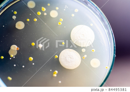Backgrounds of Characteristics and Different shaped Colony of Bacteria and Mold growing on agar plates from Soil samples for education in Microbiology laboratory. Backgrounds of Characteristics and Different shaped Colony of Bacteria and Mold growing on agar plates from Soil samples for education in Microbiology laboratory. 84495381