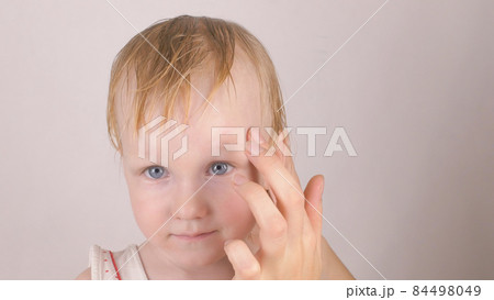 Mother treats a scar wound on the forehead of her little caucasian daughter with a healing cream against allergies and wound healing, close-up 84498049