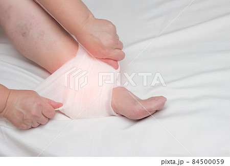 Adult woman fixes a compress on the heel spur to relieve inflammation and pain, fascia, close-up, copy space 84500059