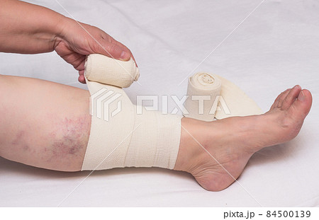 Woman bandages leg with elastic bandage against varicose veins on legs and thrombosis, close-up, white background, phlebeurysm, medical, trauma Woman bandages leg with elastic bandage against varicose veins on legs and thrombosis, close-up, white background, phlebeurysm, medical, trauma 84500139
