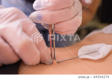 The first piercing. Dressing the earrings on the navel. Female piercing. The first piercing. Dressing the earrings on the navel. Female piercing. 84504274