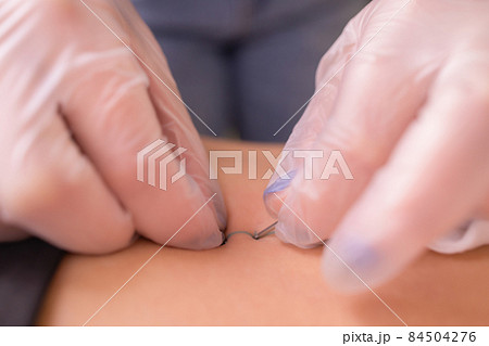 The first piercing. Dressing the earrings on the navel. Female piercing. The first piercing. Dressing the earrings on the navel. Female piercing. 84504276