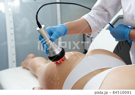 Ultrasound cavitation body contouring treatment. Woman getting anti-cellulite and anti-fat therapy in beauty salon Ultrasound cavitation body contouring treatment. Woman getting anti-cellulite and anti-fat therapy in beauty salon 84510091