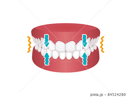 歯軋り（歯ぎしり）の種類 ベクターイラスト / クレンチング 84524280