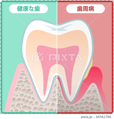 Tooth cross section Tooth cross section 84562766