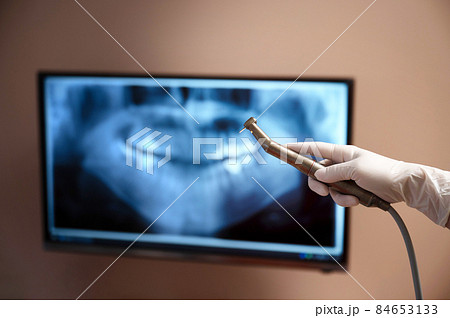 治療の前のデジタルレントゲンのイメージ 84653133