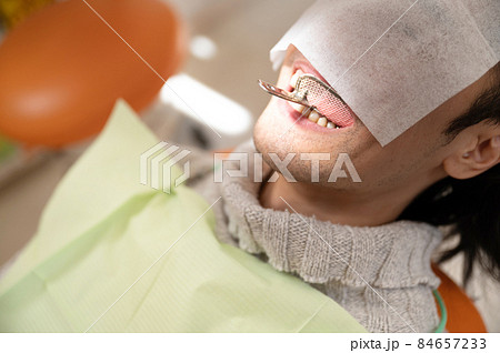 むし歯を削って歯型を取るところ1 84657233