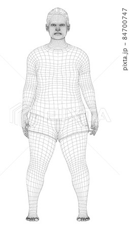 Fat woman, before weight loss 84700747