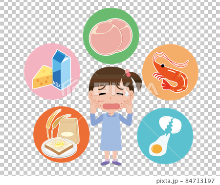 食物アレルギーで蕁麻疹が出る女の子 食物アレルギーで蕁麻疹が出る女の子 84713197