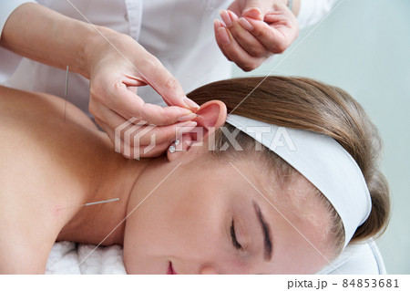 Beautiful woman relaxing on a bed having acupuncture treatment with needles in and around her ear. Alternative Therapy concept Beautiful woman relaxing on a bed having acupuncture treatment with needles in and around her ear. Alternative Therapy concept 84853681