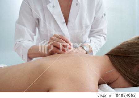 Doctor puts needles into female back on the acupuncture treatment therapy in spa salon. Alternative Medicine concept Doctor puts needles into female back on the acupuncture treatment therapy in spa salon. Alternative Medicine concept 84854065