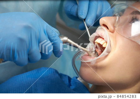 Dentist doing a dental treatment on a female patient. Dentist examining a patient's teeth in modern dentistry office 84854283