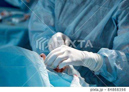 Close up of the face of a patient who is undergoing blepharoplasty. The surgeon cuts the eyelid and performs manipulations using medical instruments 84868398