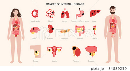 Cancer icons set Cancer icons set 84889259