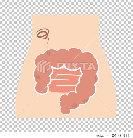 Unhealthy and reasonably dirty intestines Unhealthy and reasonably dirty intestines 84901936