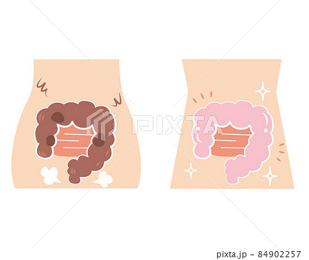 超不健康な腸と超健康な腸のセット 84902257