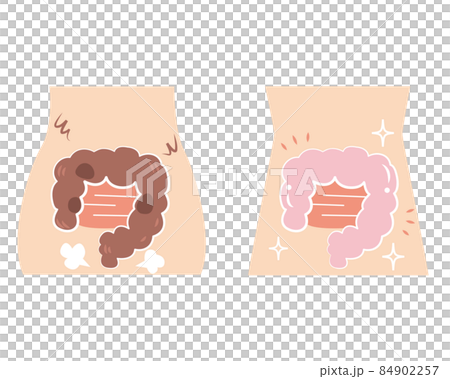 超不健康な腸と超健康な腸のセット 84902257