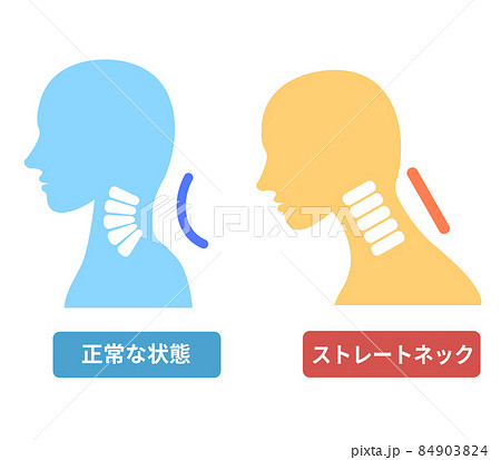 Woman with normal cervical spine and straight neck - Stock Illustration  [103561094] - PIXTA