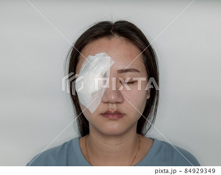 Systemic eye woman being treated from Hordeolum disease By piercing and scraping the pus out and covering it with a gauze cloth. Systemic eye woman being treated from Hordeolum disease By piercing and scraping the pus out and covering it with a gauze cloth. 84929349