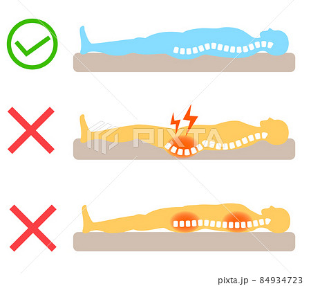 腰痛の原因　背骨とマットレスや寝具の関係 84934723