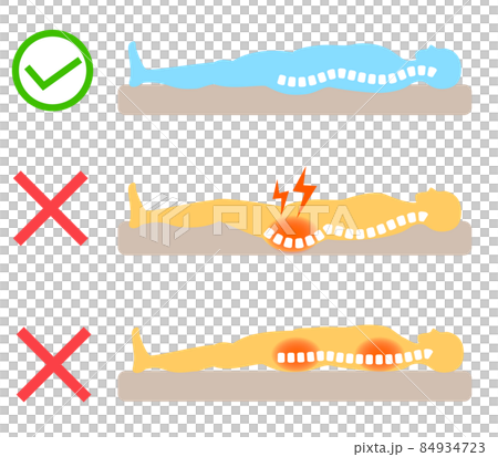 腰痛の原因　背骨とマットレスや寝具の関係 84934723