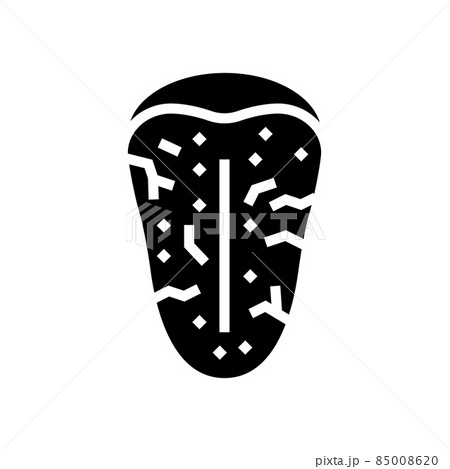 sjogrens syndrome glyph icon vector illustration 85008620