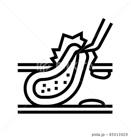 carotid endarterectomy line icon vector illustration 85013929