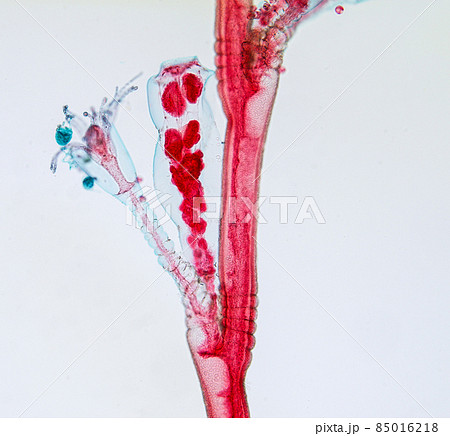 Hydra is a genus of small, fresh-water animals of the phylum Cnidaria and class Hydrozoa under the microscope for education. Hydra is a genus of small, fresh-water animals of the phylum Cnidaria and class Hydrozoa under the microscope for education. 85016218