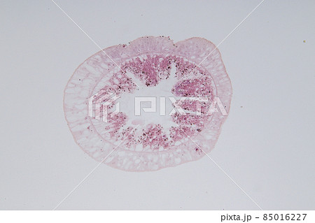 Hydra is a genus of small, fresh-water animals of the phylum Cnidaria and class Hydrozoa under the microscope for education. 85016227