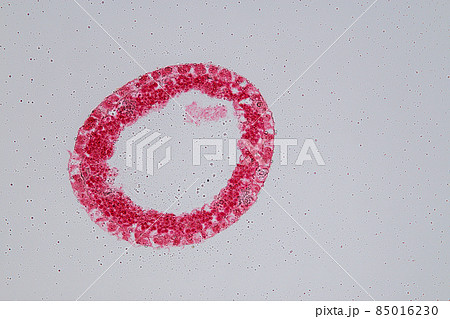 Hydra is a genus of small, fresh-water animals of the phylum Cnidaria and class Hydrozoa under the microscope for education. 85016230