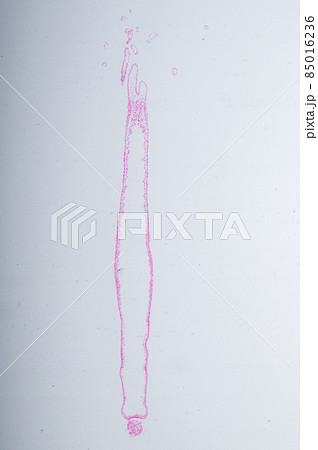 Hydra is a genus of small, fresh-water animals of the phylum Cnidaria and class Hydrozoa under the microscope for education. 85016236