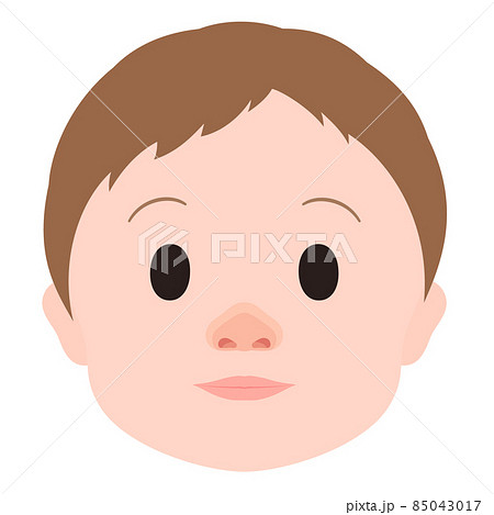 口唇口蓋裂_健常_術後のイラスト_顔 口唇口蓋裂_健常_術後のイラスト_顔 85043017