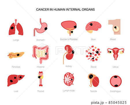 Cancer icons set 85045025