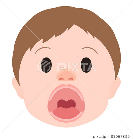 口唇口蓋裂_正常_術後のイラスト_顔_開口 口唇口蓋裂_正常_術後のイラスト_顔_開口 85067339