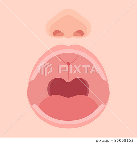 切歯孔のイラスト_アップ_開口_口腔 切歯孔のイラスト_アップ_開口_口腔 85068153