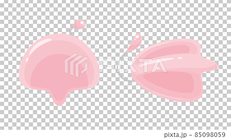 口唇口蓋裂_ホッツ床のイラスト_Hotz床_NAMあり 85098059