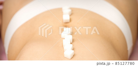 Sugar cubes lying in a row on abdomen of young woman, the concept of intimate depilation, problems of intimate hygiene. 85127780
