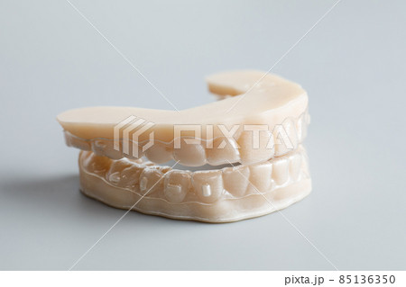 Individual silicone tooth tray for whitening. Teeth whitening concept. 85136350