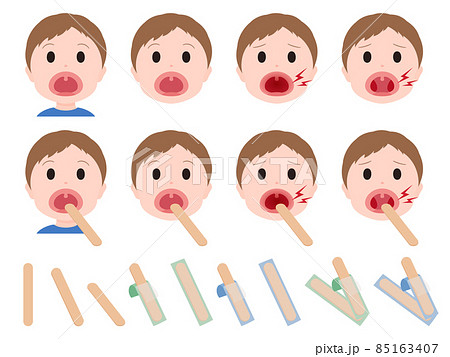 舌圧子と喉を診察する男の子のイラスト素材セット 舌圧子と喉を診察する男の子のイラスト素材セット 85163407