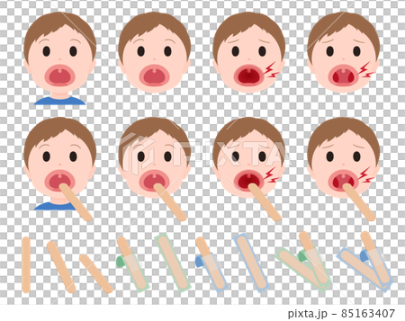 舌圧子と喉を診察する男の子のイラスト素材セット 舌圧子と喉を診察する男の子のイラスト素材セット 85163407