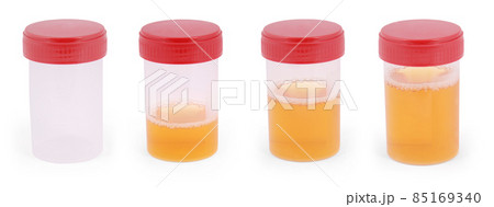 Sterile Medical container for urine with biomaterial 85169340