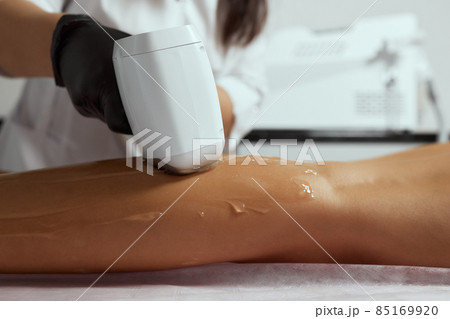 Young African woman getting laser hair removal on her thighs. Young African woman getting laser hair removal on her thighs. 85169920