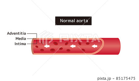 血管・大動脈の断面図イラスト (英語) 血管・大動脈の断面図イラスト (英語) 85175475